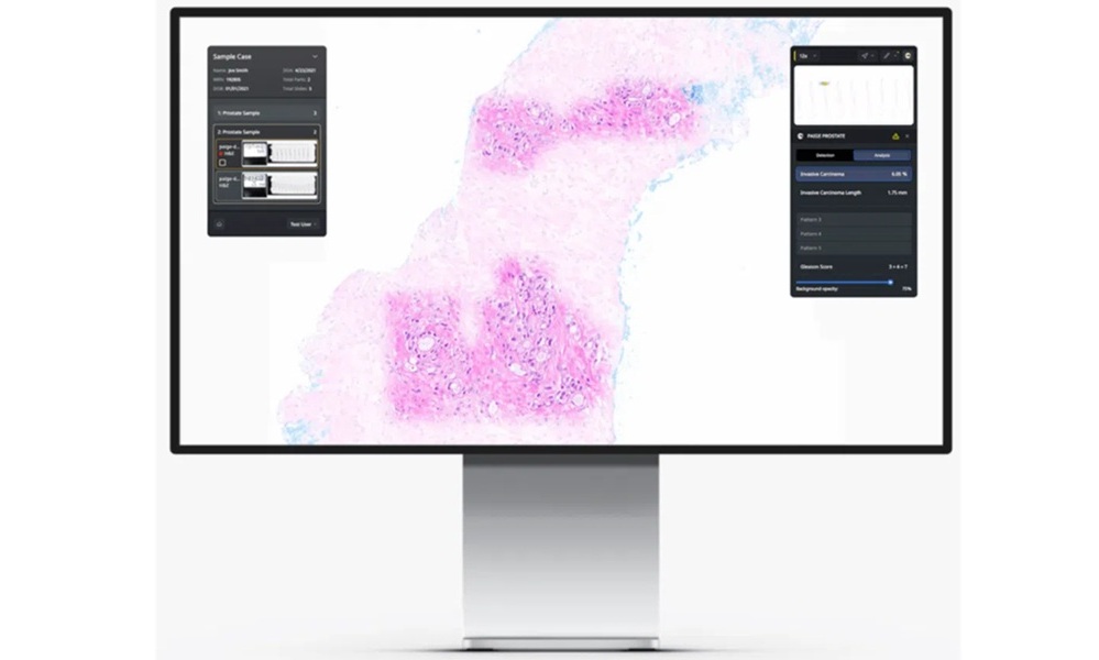 Image: Tempus will open source the Paige IMS, including its slide viewer, case management solution, and AI integration modules, providing a clinical-grade baseline platform for institutions worldwide (Photo courtesy of Tempus)