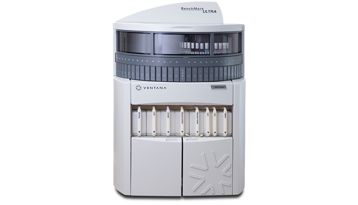 Image: The VENTANA PTEN (SP218) RxDx Assay is a qualitative IHC assay for assessing PTEN protein in prostate adenocarcinoma, with staining performed using the OptiView DAB IHC Detection Kit on a BenchMark ULTRA instrument (Photo courtesy of Roche)