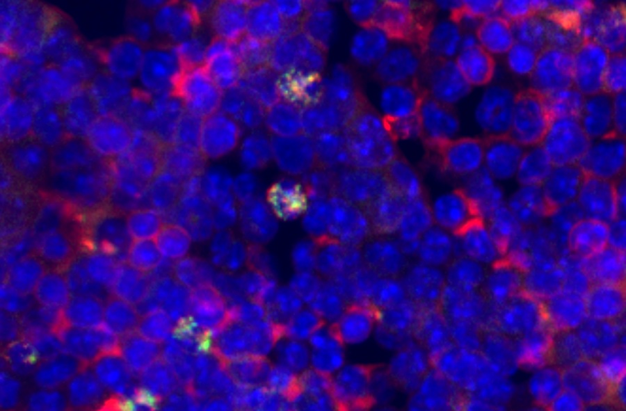 Image: Hematopoietic stem cells (white), which produce all blood cells in the body, seen alongside blood cells (blue and red) in the bone marrow. (Image credit: Brian Heubel, Passegué laboratory, Columbia Stem Cell Initiative) Image: Hematopoietic stem cells (white), which produce all blood cells in the body, seen alongside blood cells (blue and red) in the bone marrow. (Image credit: Brian Heubel, Passegué laboratory, Columbia Stem Cell Initiative)