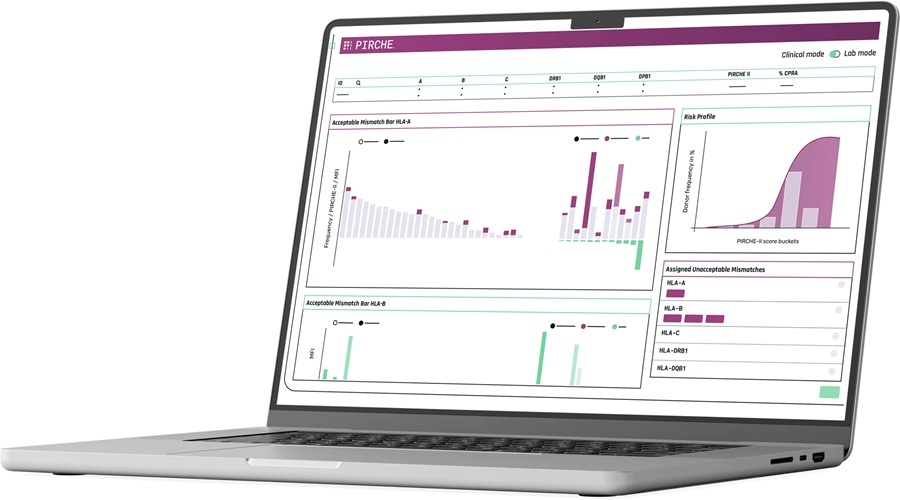 Image: At the core of the collaboration is Pirche’s TxPredictor platform, which uses proprietary algorithms to analyze histocompatibility and predict immunological risk (Photo courtesy of Pirche AG)