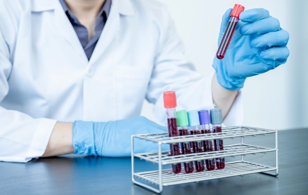 Image: Findings showed that the Stockholm3 blood test detected more clinically significant prostate cancers than PSA testing without increasing unnecessary testing (Image credit: 123RF)