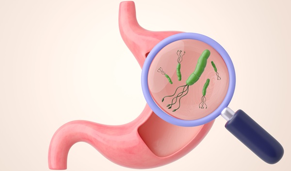 Image: The model estimated about a fivefold return in gastric cancer prevention benefits per unit invested, with cost-effectiveness maintained in higher-cost settings (Image credit: Adobe Stock)