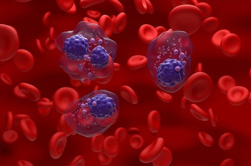 Image: New findings show that the transcription factor IRF2 has both pathogenic and prognostic significance in multiple myeloma (Image Credit: Shutterstock)