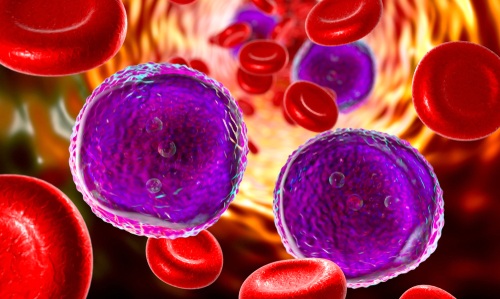 Image: A new AI assistant supports treatment decisions in complex blood cancers (Image Credit: Shutterstock)