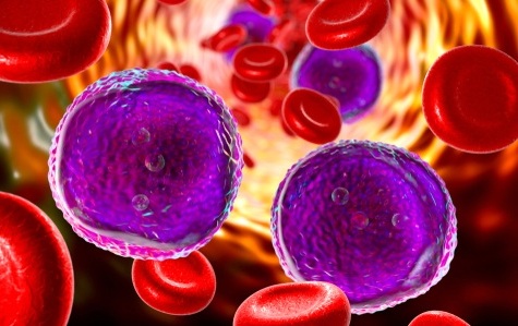 Image: A new AI assistant supports treatment decisions in complex blood cancers (Image Credit: Shutterstock)