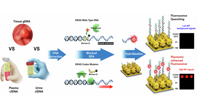 Image:Schematic illustration of plasmonic microarray–based KRAS mutation detection from colorectal cancer patients. (Lee, J.Y., Mun, C.W., Kim, E.R. et al. npj Precision Oncology, 2026. https://doi.org/10.1038/s41698-026-01452-8)