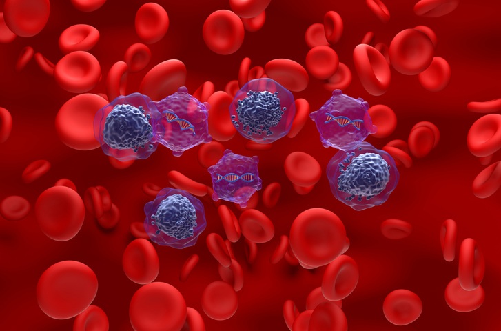 Image: The findings show that epigenetic analyses can divide leukemia into biologically relevant subgroups, providing more information than genetics alone (Image Credit: iStock)