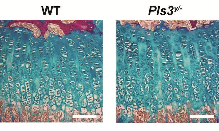 An image of an epiphyseal plate, the area at the end of bones where new bone is formed. In blue are chondrocytes – cells that produce cartilage – and brown at the bottom is new bone (Photo courtesy of Garvan Institute) An image of an epiphyseal plate, the area at the end of bones where new bone is formed. In blue are chondrocytes – cells that produce cartilage – and brown at the bottom is new bone (Photo courtesy of Garvan Institute)