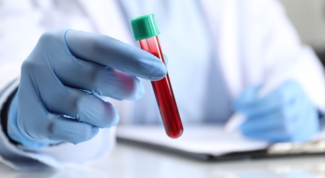 Image: Accurately assessing LDL cholesterol is increasingly important as guidelines recommend lower treatment targets, while underestimation can lead to missed treatment opportunities (Image Credit: 123RF)