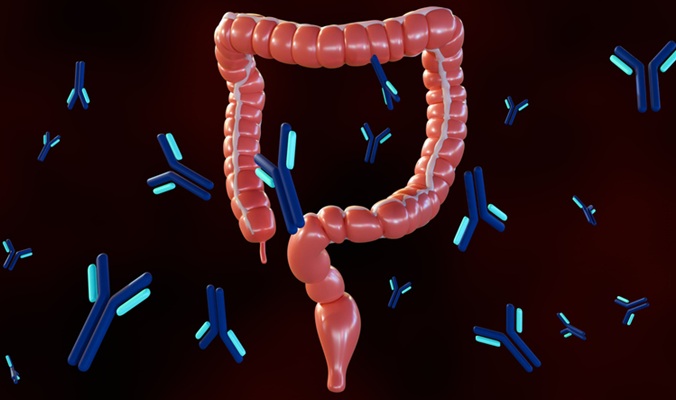 Image: New findings show unique pathogen‑directed antibody patterns are already present years ahead of a formal diagnosis of inflammatory bowel disease (Image Credit: iStock)