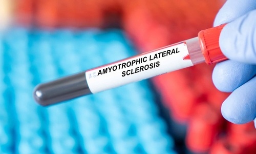 Image: New findings demonstrate that a defined panel of plasma proteins can forecast when ALS symptoms will appear. (Image Credit: Shutterstock)