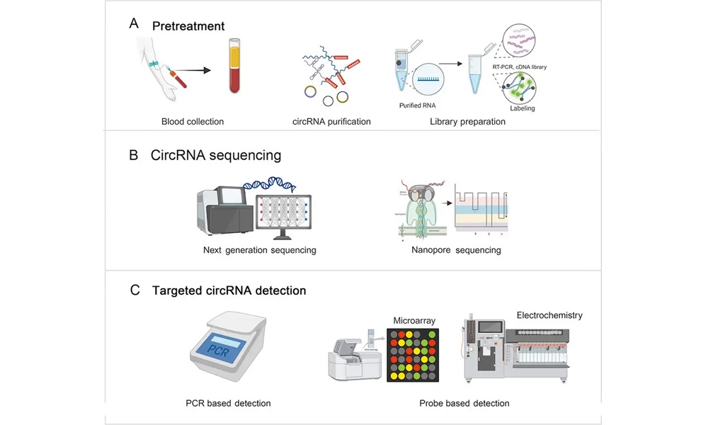 Image: Analysis methods of circRNAs in circulation (Zhang Y, Chen G, Liu Z, Song X. Circulating circRNAs at the frontier of cancer detection, prognosis, and therapy. Chin Med J. Published ahead of print June 24, 2026. doi:10.1097/CM9.0000000000004120)