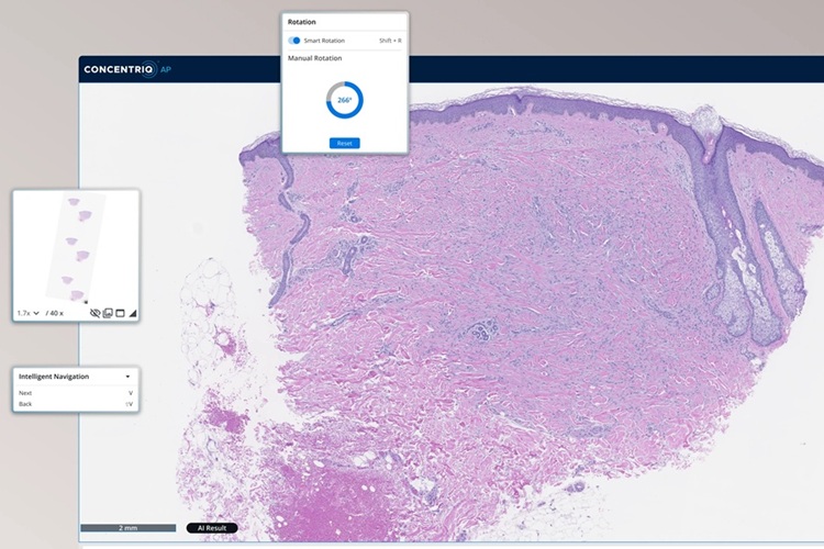 Image: Through the PCCP, Proscia gains a more efficient pathway to expand Concentriq AP-Dx interoperability while maintaining regulatory oversight (Photo courtesy of Proscia)