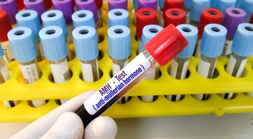 Image: New findings demonstrate that anti-Müllerian hormone (AMH) may help identify which breast cancer patients are most likely to benefit from chemotherapy plus endocrine therapy (Image Credit: Shutterstock)