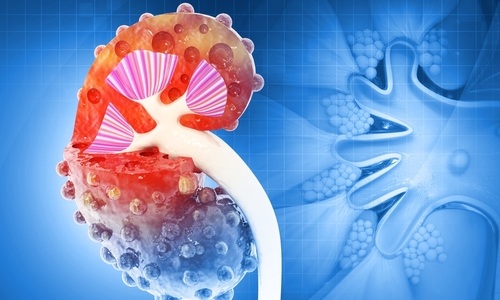 Image:  Estimates suggest that 30–50% of CKD cases go undiagnosed in high‑income countries, with even higher proportions likely in middle‑ and lower‑income countries (Image Credit: Shutterstock)