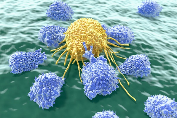 Image: Researchers evaluated AI models that quantify tumor-infiltrating lymphocytes (TIL) on routine breast tissue slides, where higher TIL levels reflect stronger antitumor response and improved breast cancer outcomes (Image Credit: Shutterstock)