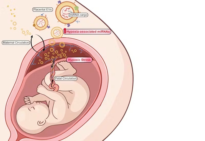 Image: In the Fetal Extracellular Vesicle Monitoring of Oxygenation (FEMOx) project several of the Wyss Institute’s Technology Platforms and faculty labs join forces. Leveraging and integrating multiple of the Wyss Institute’s technological innovations and advanced analytical capabilities they aim develop a test that can rapidly and accurately detect fetal oxygen deprivation by detecting specific miRNA signatures in extracellular vesicles (EVs) that circulate in maternal blood. (Iimage Credit: Wyss Institute at Harvard University)