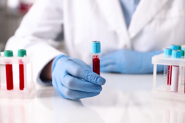 Image: Blood protein levels can reveal whether genetic variants have biological effects, potentially offering a more scalable, noninvasive way to obtain additional patient information (Image Credit: 123RF)
