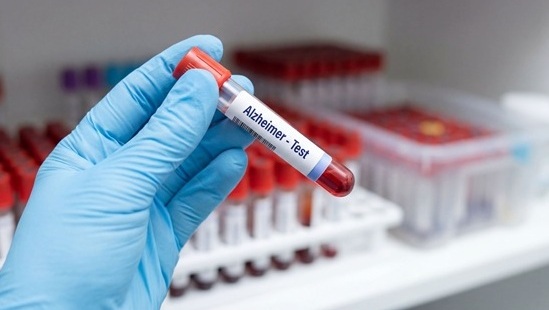Image: Researchers found that combining two Alzheimer’s tests—a p-tau217 blood test and APOE genotyping—can predict symptom onset in people who are not yet experiencing symptoms (Image Credit: Adobe Stock)