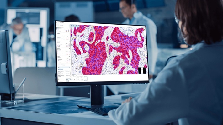 Image: Aiforia and Stratipath will integrate Stratipath Breast into the Aiforia Clinical Platform, giving laboratories access to both companies’ breast cancer AI tools in one workflow (Photo courtesy of Aiforia)