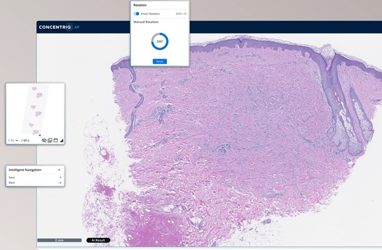 Image: Concentriq AP-Dx supports primary diagnosis from digital pathology slides and is FDA-cleared, Health Canada-licensed, and CE-marked under the EU IVDR. (Photo courtesy of Proscia)