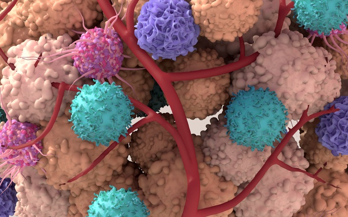 Image: A new study demonstrates that vascular features in colorectal tumors could serve as prognostic biomarkers of disease outcome. (Image Credit: iStock)
