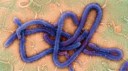 Image: Ebola remains a rapidly evolving public health threat with high mortality, underscoring the need for timely diagnosis and decentralized testing closer to patients (Image Credit: Adobe Stock)