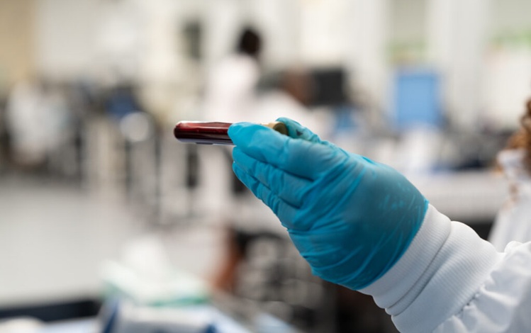Image: GRAIL’s Galleri test uses machine learning to analyze cfDNA patterns for cancer signals and predict their likely location to guide further evaluation.
