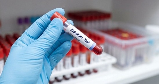 Image: Collaboration combines cognitive assessment, blood testing, phlebotomy, and MRI to support faster diagnosis across the UK (Image Credt: Adobe Stock)