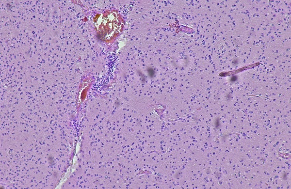 Image: longer and is more labor-intensive. The approach images fresh, unprocessed tissue in under a minute, avoiding the slower, labor-intensive staining required in conventional pathology (Image Credit: Adobe Stock)