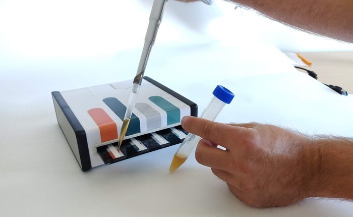 Image: Researchers from the Department of Chemistry at Aarhus University have developed and tested a new technology that can identify and measure the concentration of pharmaceuticals in under 10 minutes. Today, this process takes up to an hour. That is critical waiting time for patients suffering from a stroke. (Image Credit: Aarhus University)