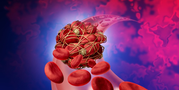 Image: The system is designed to measure blood viscoelasticity and density to assess coagulation from clot formation through breakdown in less than 10 minutes.(Image Credit: iStock)