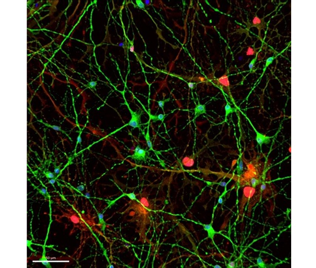 Image: Cell culture of induced pluripotent stem cells (iPSCs). Neurons are shown in green and astrocytes in red. (Photo courtesy of Carlos Avilés Granados)