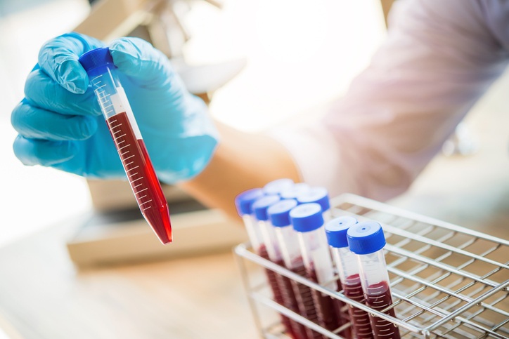 Image: Blood proteins measured years before diagnosis may signal future prostate cancer risk, including aggressive disease.(Image Credit: iStock)