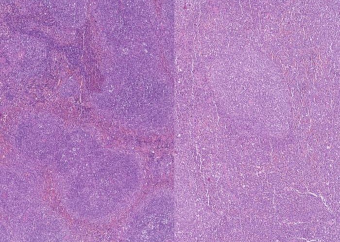 Image: Spleen tissue from a mouse without PHF19 (left) and a mouse with normal PHF19 function (right). Dense clusters of immune cells sit within blood-rich regions in pink. Without PHF19, cells are altered in their differentiation process (Photo courtesy of Gianni Gamarra/Centro de Regulación Genómica)