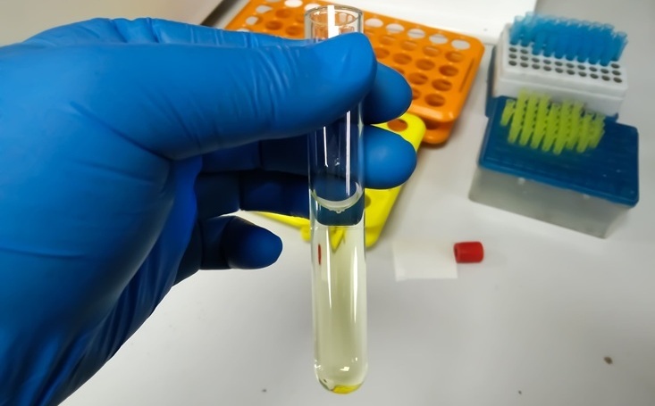 Image: The approach analyzes tumor-derived DNA fragments in CSF collected by lumbar puncture, assessing individual gene changes and broader tumor-associated DNA patterns. (Image Credit: Adobe Stock)