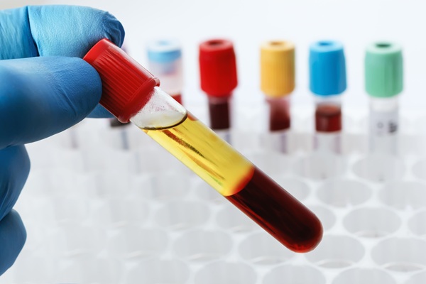 Image: A new study identified 17 plasma proteins linked to mortality in older adults, several of which also track biological ageing across multiple organ systems. (Image Credit: Adobe Stock)