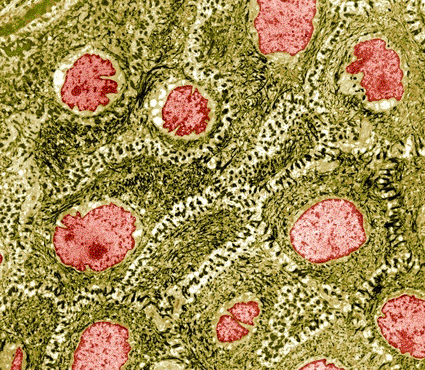 Image: Colored transmission electron micrograph (TEM) of a section through keratinocyte skin cells, which are found in the epidermis layer of the skin (Photo courtesy of Steve Gschmeissner / SPL).