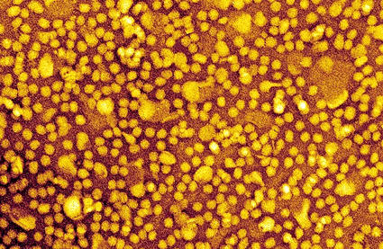 Image: Colored transmission electron micrograph (TEM) of low-density lipoprotein (LDL) particles (Photo courtesy of SPL).