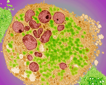 Image: Colored transmission electron micrograph (TEM) of a section through a bladder cancer cell (Photo courtesy of Steve Gschmeissner / SPL).