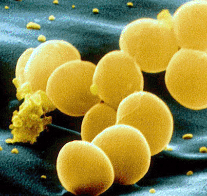 Image: Colored scanning electron micrograph (SEM) of a cluster of Staphylococcus aureus bacteria (Photo courtesy of the Eye of Science / SPL).
