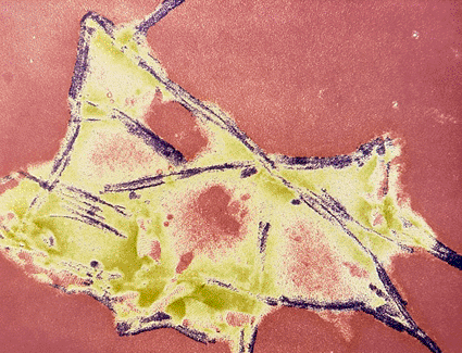 Image: False-color transmission electron micrograph (TEM) of fibrils in an extract of fresh brain from a cow infected with Bovine spongiform encephalopathy (BSE) (Photo courtesy of EM Unit, CVL, Weybridge).