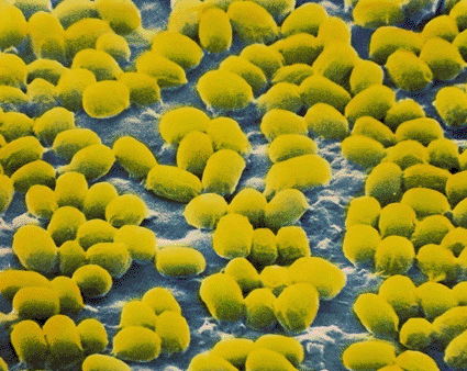 Image: Colored scanning electron micrograph (SEM) of <i>Bacillus anthracis</i> spores. This bacterium causes anthrax in farm animals and less commonly in humans (Photo courtesy of NIBSC / SPL).