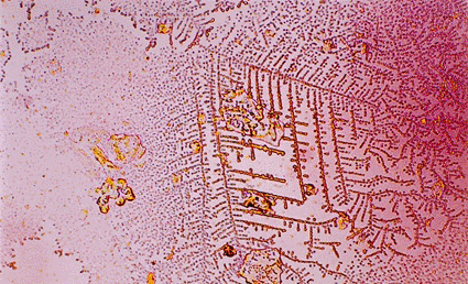 Image: Light micrograph of human saliva (Photo courtesy of CMSP).