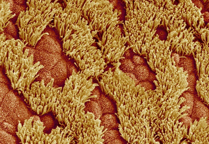 Image: Colored scanning electron micrograph (SEM) of the lining of the trachea (Photo courtesy of Susumu Nishinaga). Image: Colored scanning electron micrograph (SEM) of the lining of the trachea (Photo courtesy of Susumu Nishinaga).
