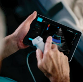 FUJIFILM SonoSite iViz portable ultrasound platform integrated with mobile computing and advanced connectivity
