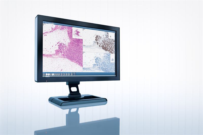 Sectra Digital Pathology Solution