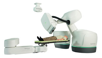 The CyberKnife Stereotactic Body Radiation Therapy System