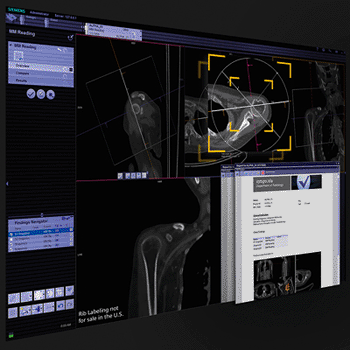 Image: syngo.via General Engine is a new package of highly automated and standardized applications. As depicted here, the feature “Anatomical Range Presets” displays a quick, precise, optimal view of selected anatomical regions. (Photo courtesy of Siemens Healthcare).