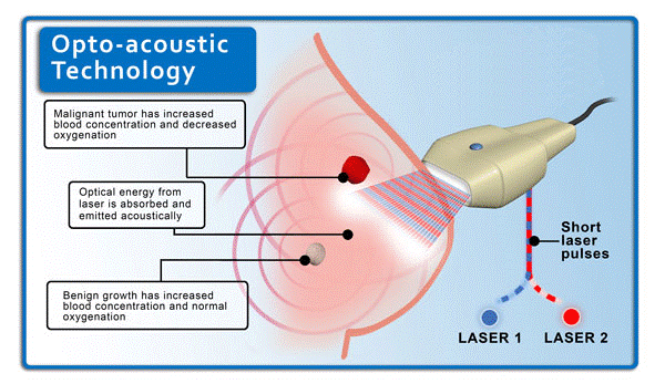 Image: Optoacoustic imaging combines light and sound to produce high-resolution, high-contrast images to indicate the presence of angiogenesis. Malignant tumor has increased blood concentration and decreased oxygenation (top) ; Optical energy is absorbed and emitted acoustically (middle); Benign growth has increased blood concentration and normal oxygenation (bottom) (Photo courtesy of Seno Medical Instruments).